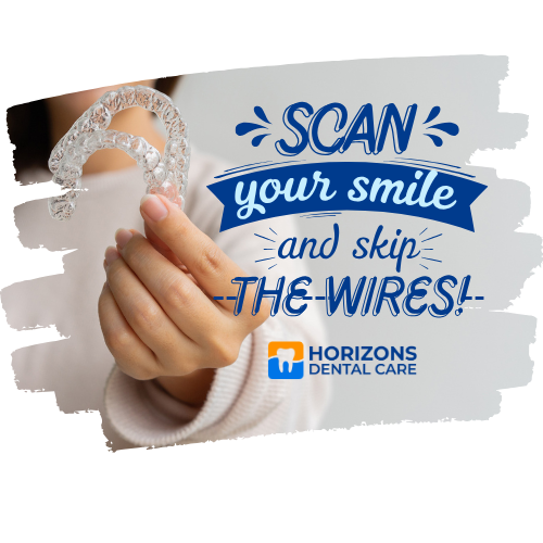 Clear Aligners